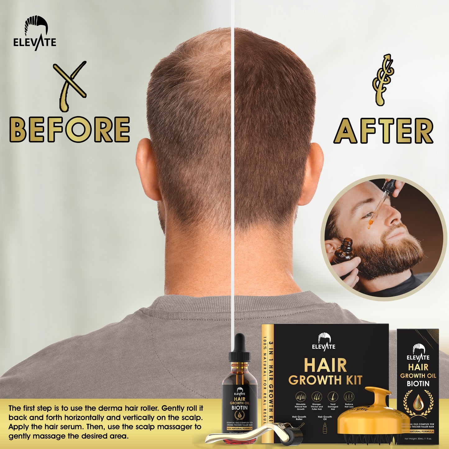 Elevate 3-in-1 Hair Derma Roller Kit