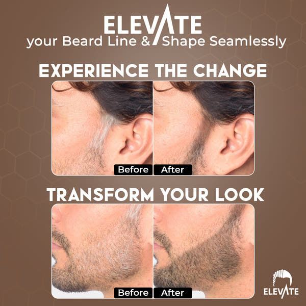 Elevate Hair Line Powder Instantly Conceal Hair Loss for Thinning Areas - Root Cover Touch Up with Puff Touch - Instant Gray Coverage