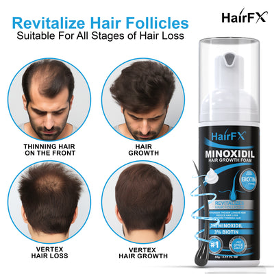 HairFX 5% Minoxidil Foam with Biotin | Topical Hair Regrowth Treatment