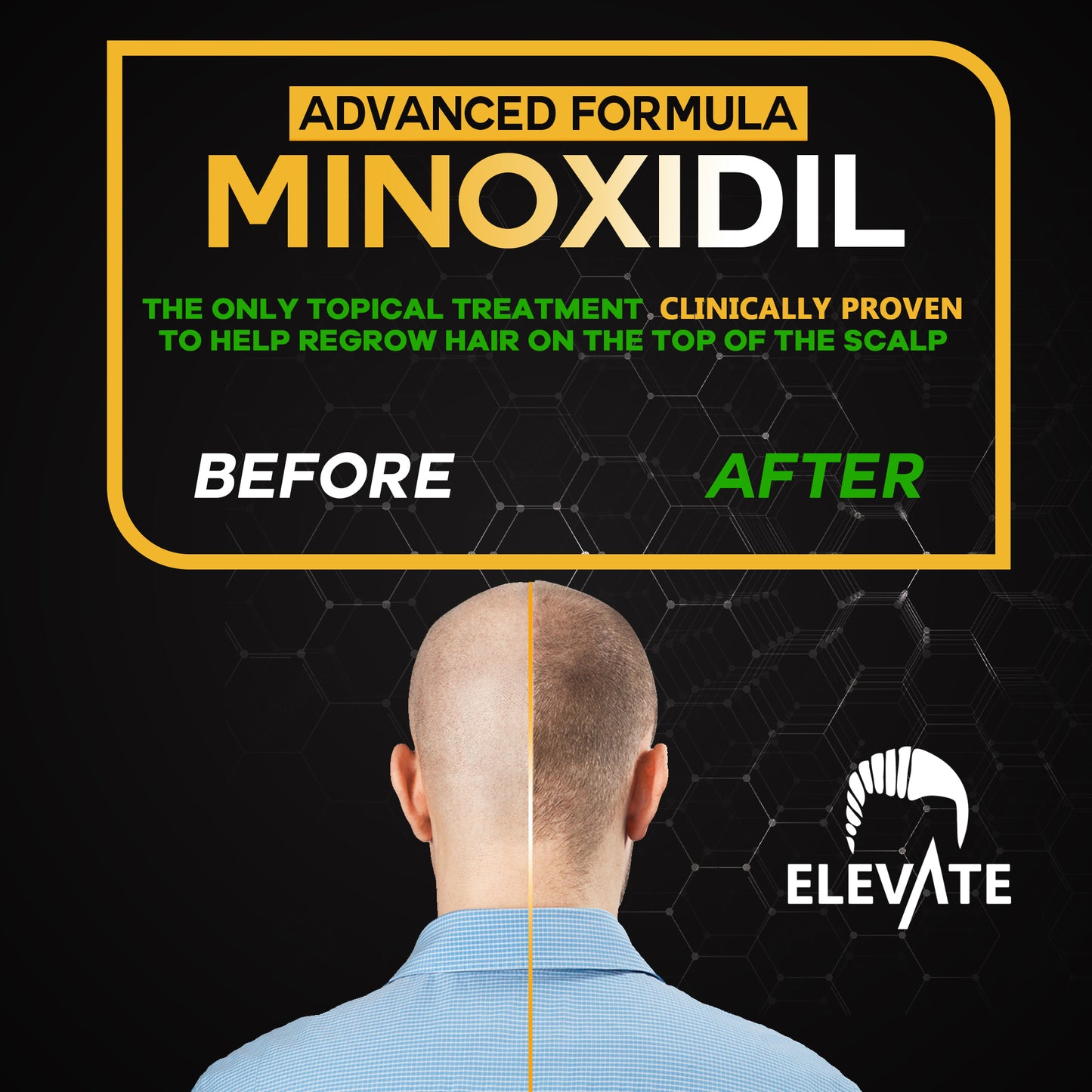 ELEVATE 5% Herbal Minoxidil Spray (Alcohol-Free)