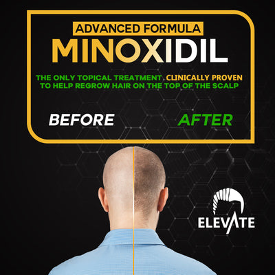 ELEVATE 5% Herbal Minoxidil Spray (Alcohol-Free)
