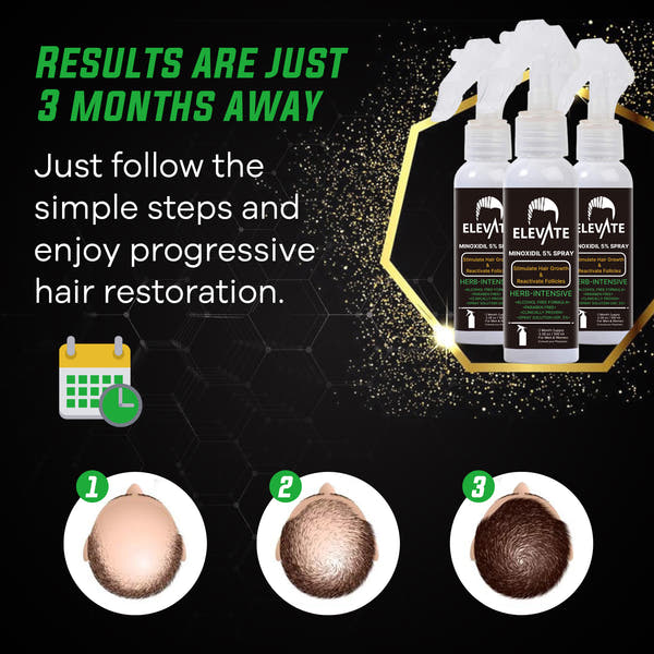 ELEVATE 5% Herbal Minoxidil Spray (Alcohol-Free)