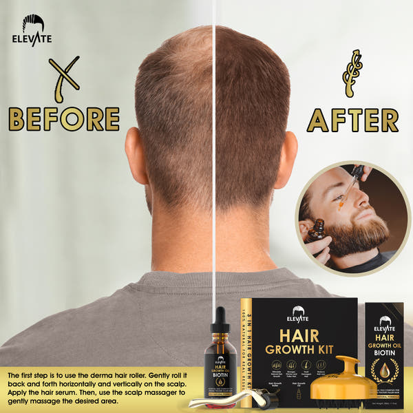 Elevate 3-in-1 Hair Derma Roller Kit