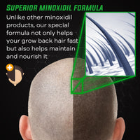 ELEVATE 5% Herbal Minoxidil Spray (Alcohol-Free)