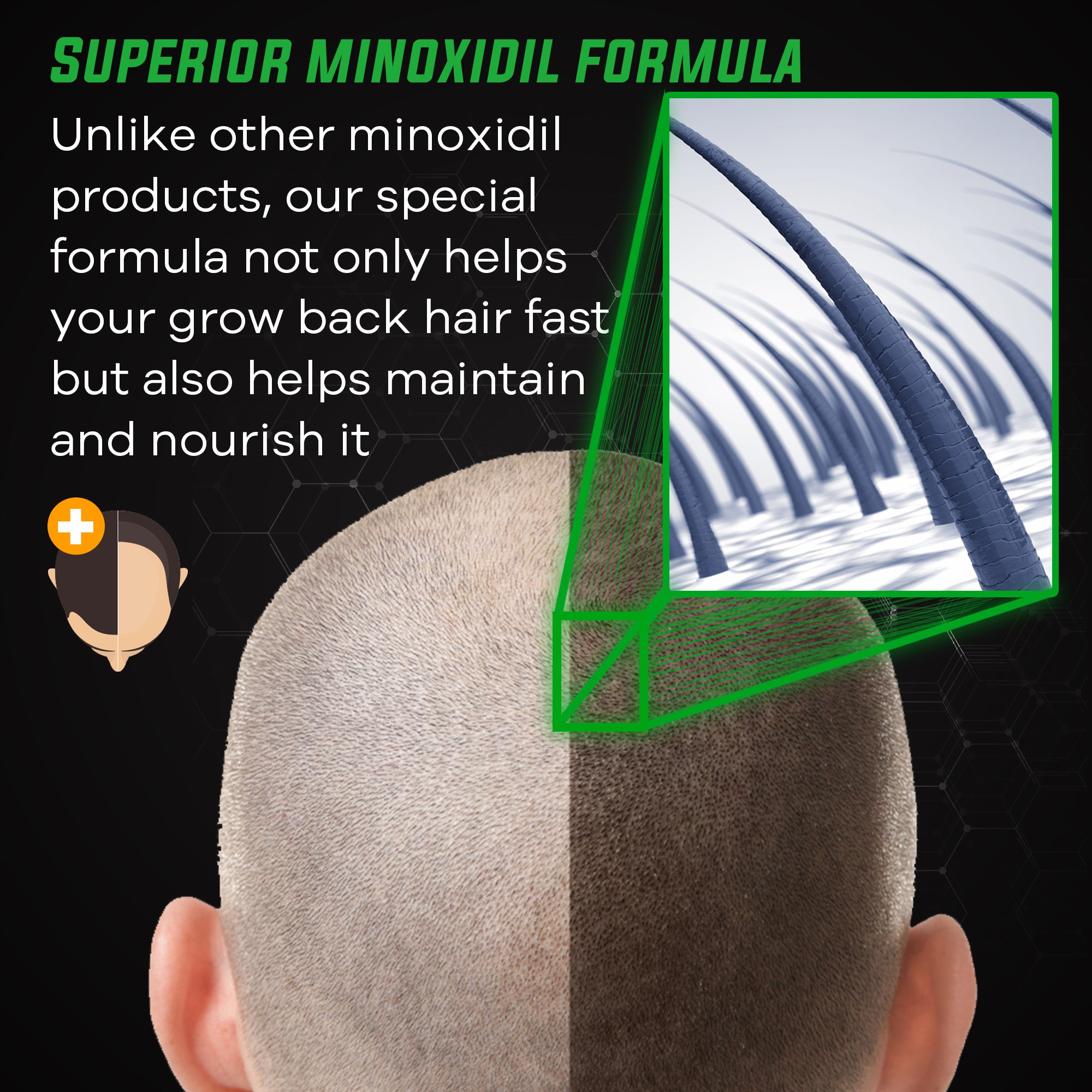 ELEVATE 5% Herbal Minoxidil Spray (Alcohol-Free)