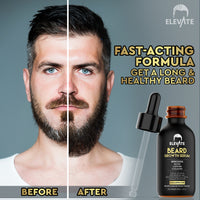 ELEVATE 5% Minoxidil Beard Growth Oil