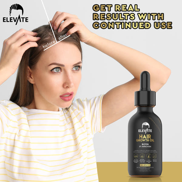 ELEVATE 5% Minoxidil Hair Growth Oil